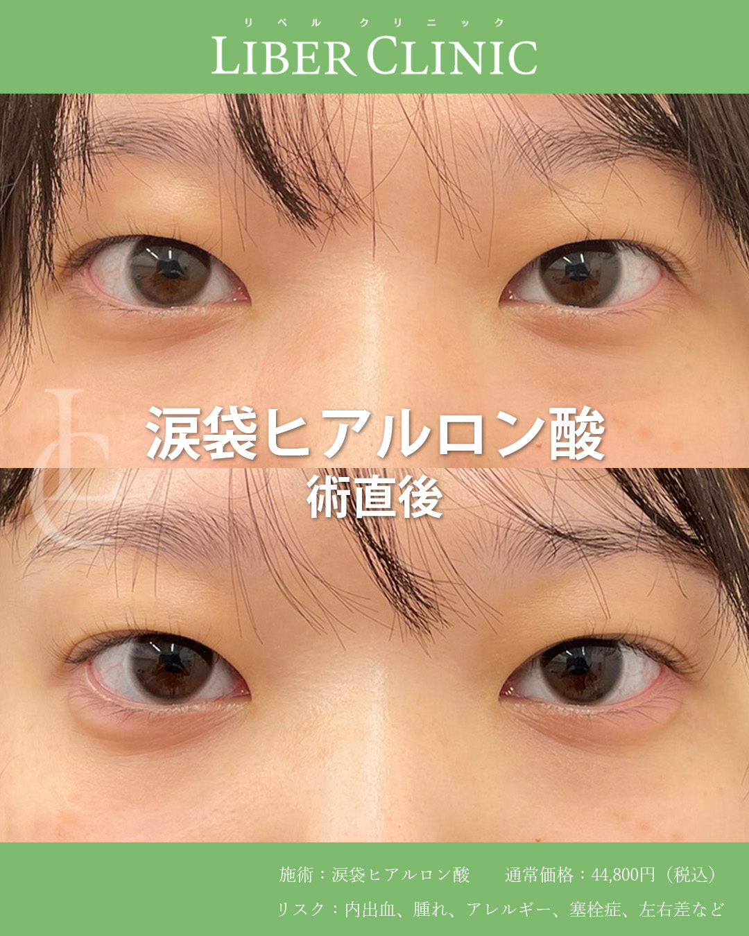 処置前と処置直後