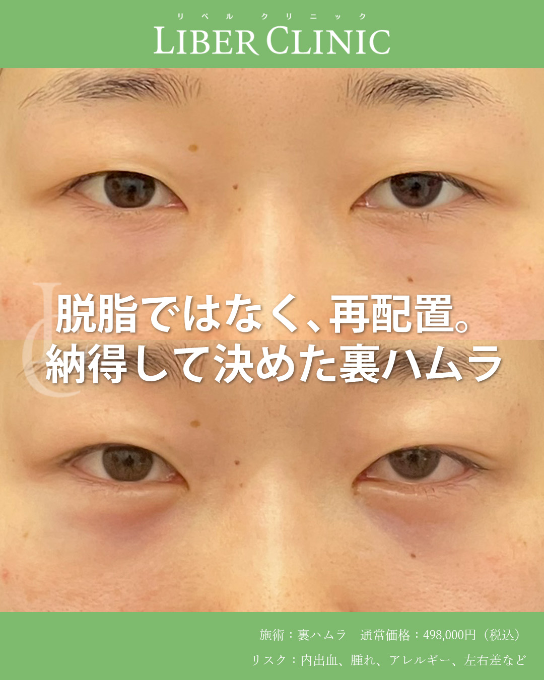 脱脂ではなく、再配置。納得して決めた裏ハムラ