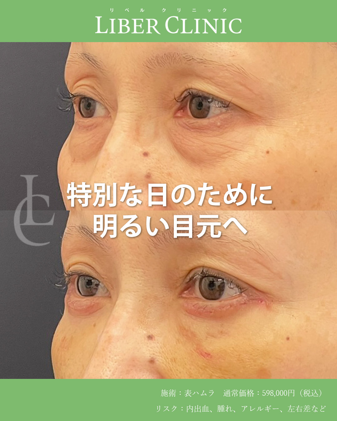 斜めから見てもしっかり変化が出てます
