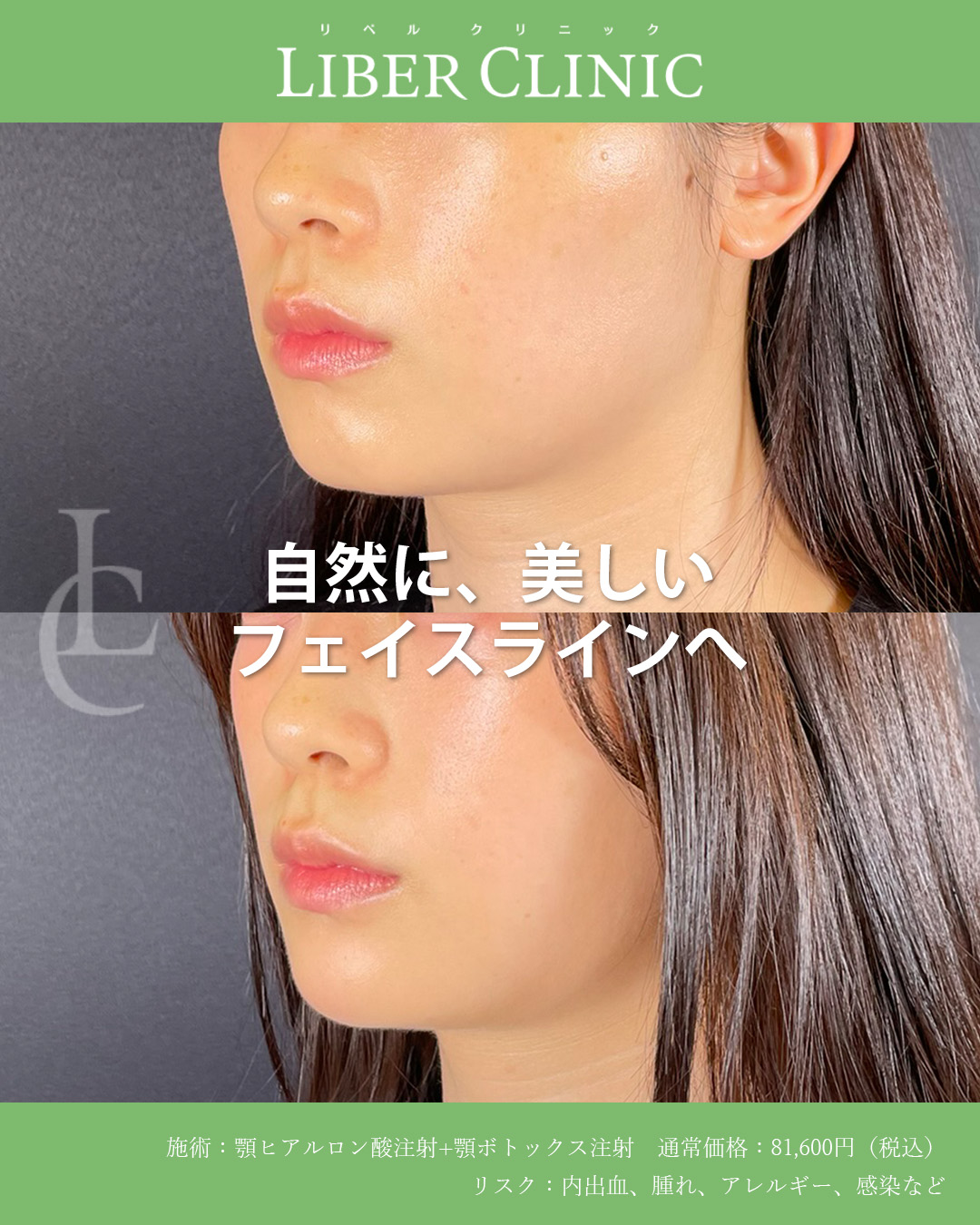 自然に、美しいフェイスラインへ