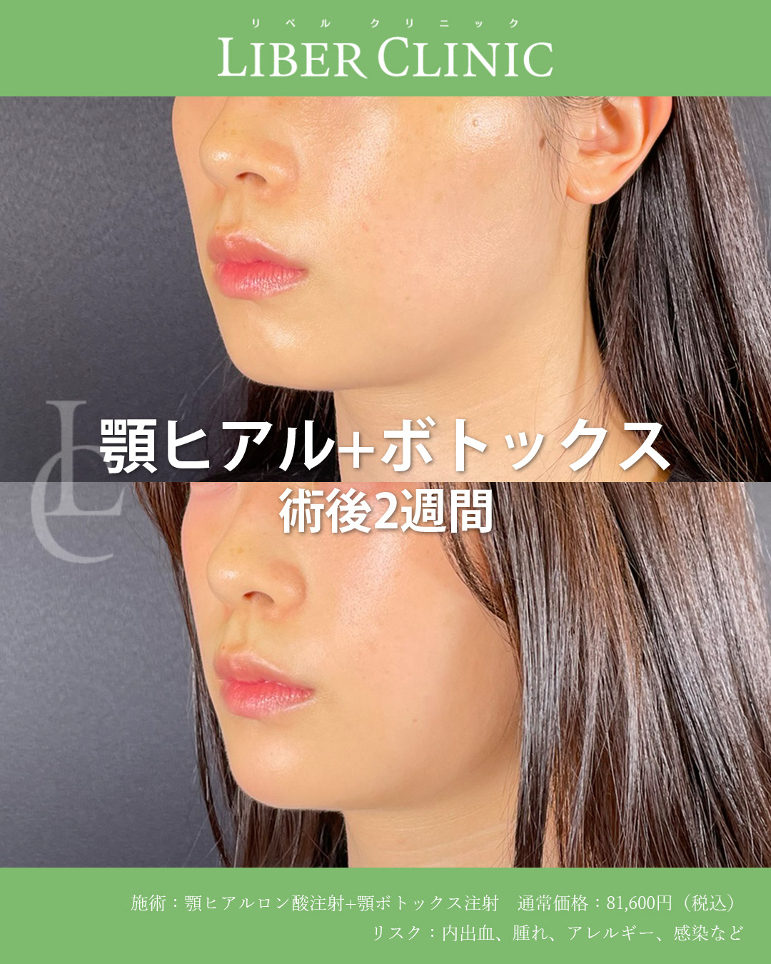 手術前と術後2週間