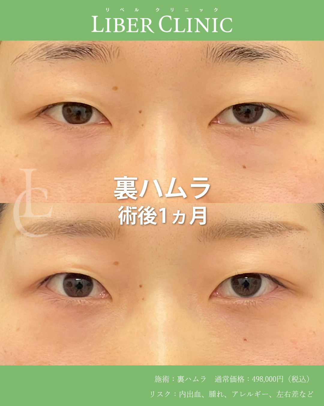 脱脂ではなく、再配置。納得して決めた裏ハムラ