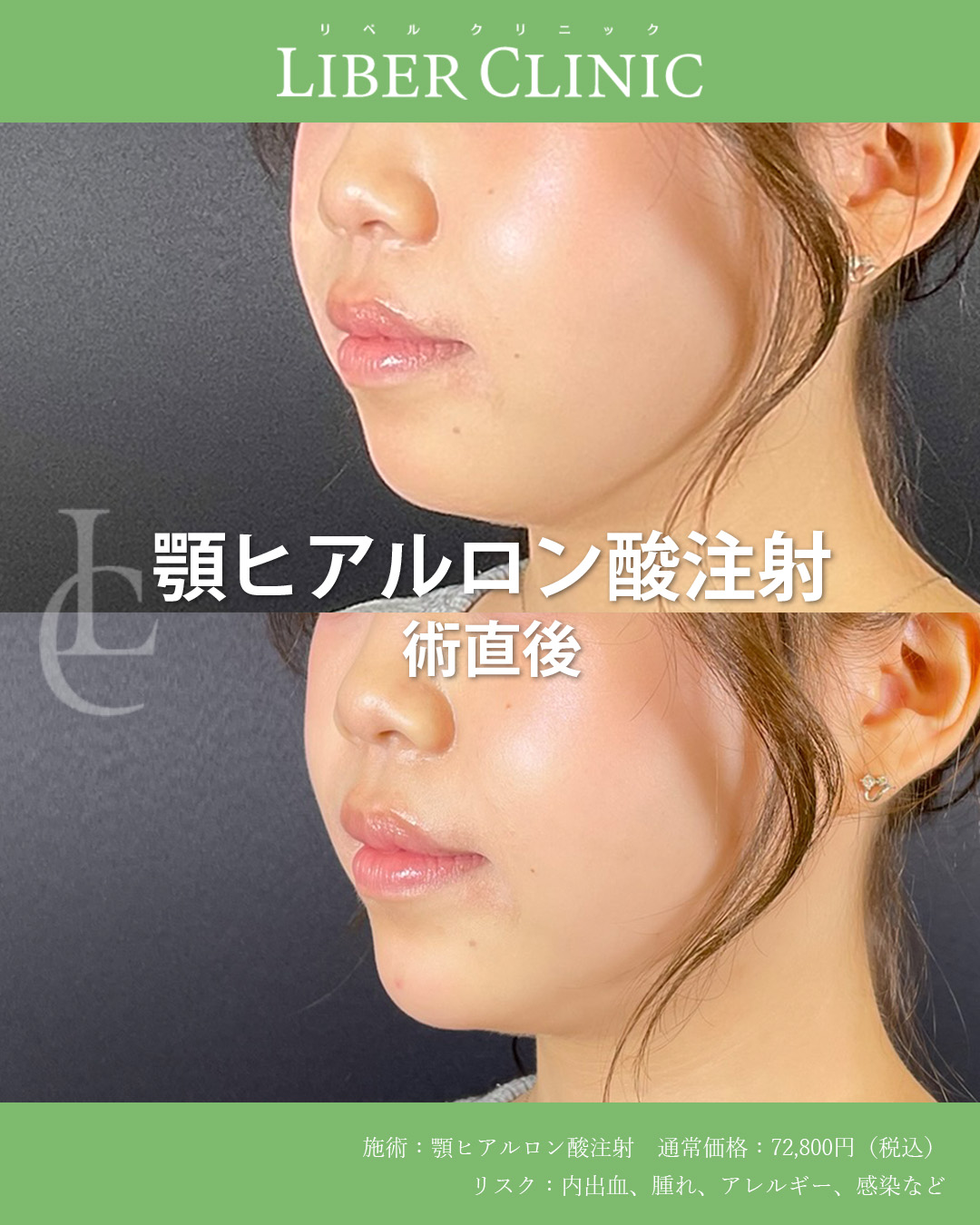 顎先で作る美バランス