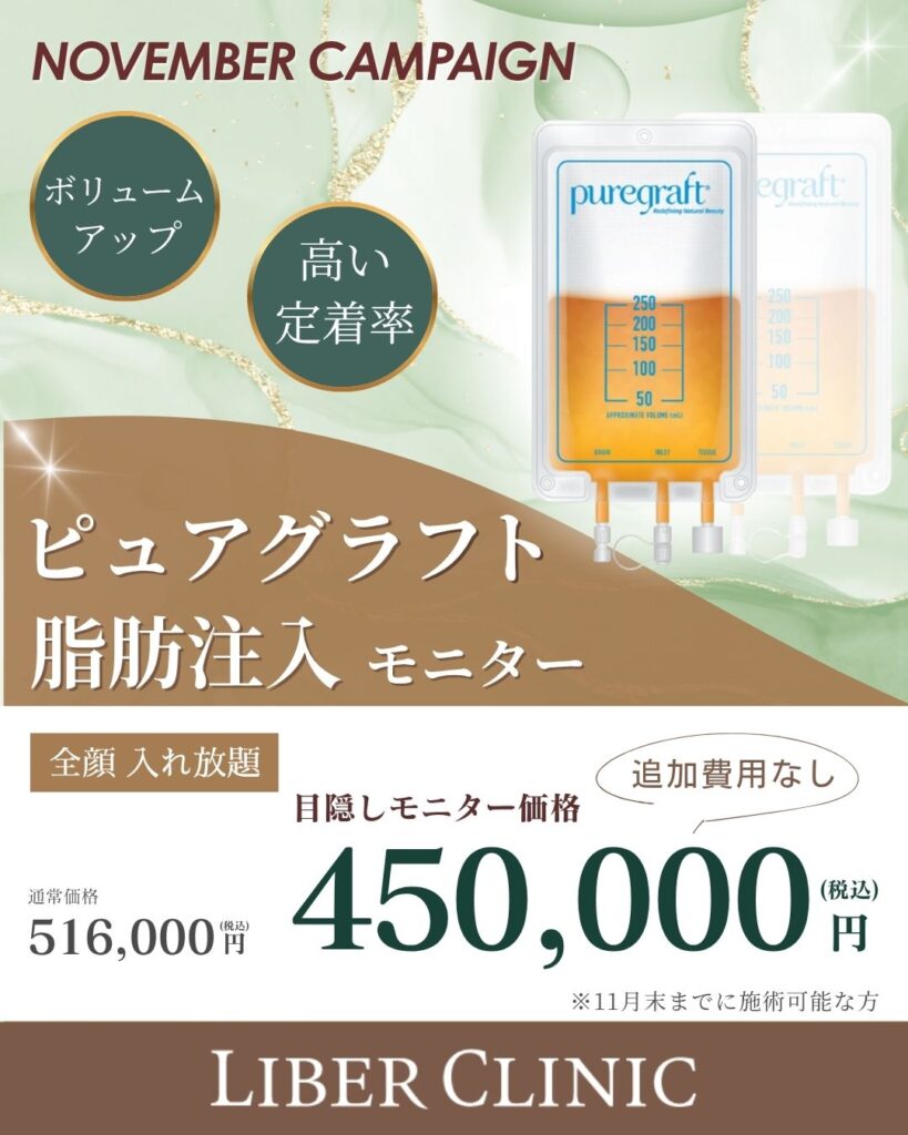 キャンペーン:ピュアグラフト脂肪注入モニター