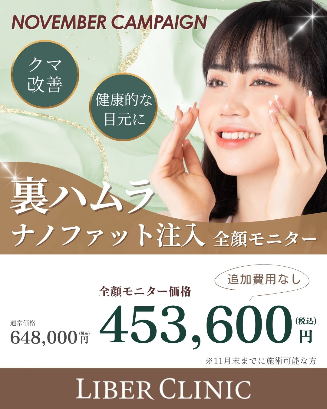 裏ハムラ+脂肪注入|全顔モニター