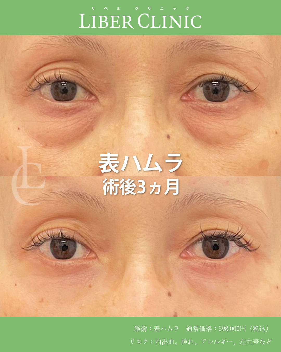 目元を緻密に整える表ハムラ