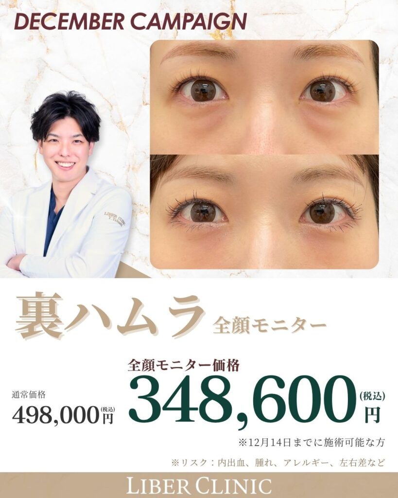 裏ハムラ｜全顔モニター