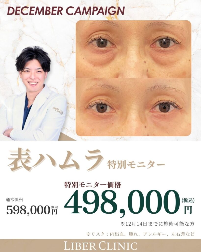 表ハムラ｜特別モニター