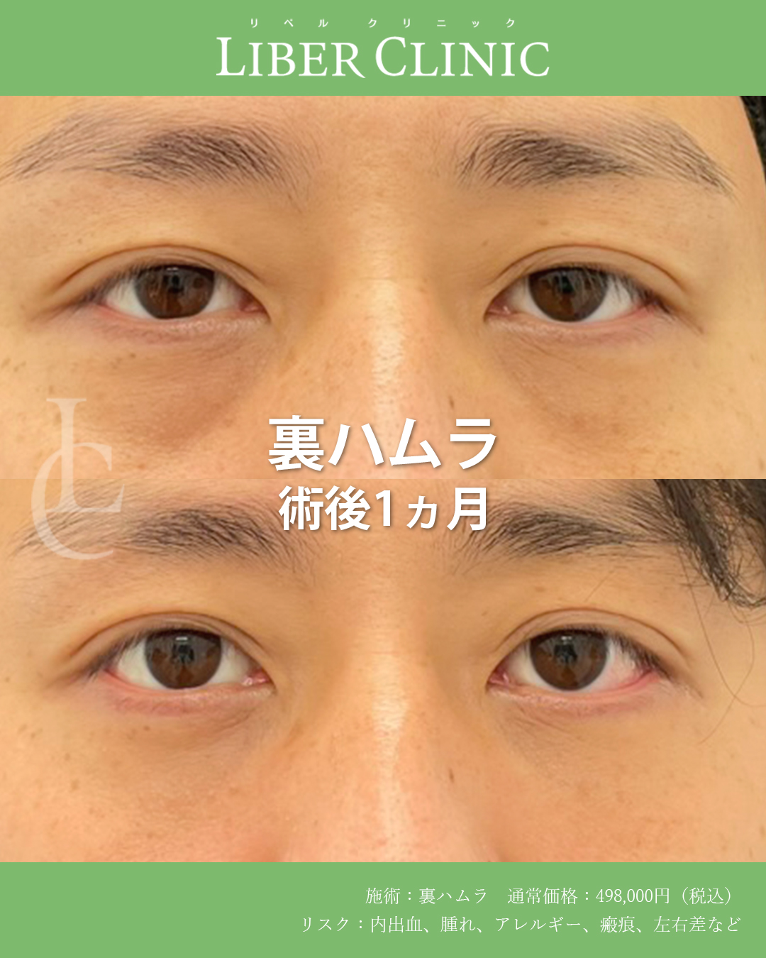 裏ハムラはメンズ美容の新定番