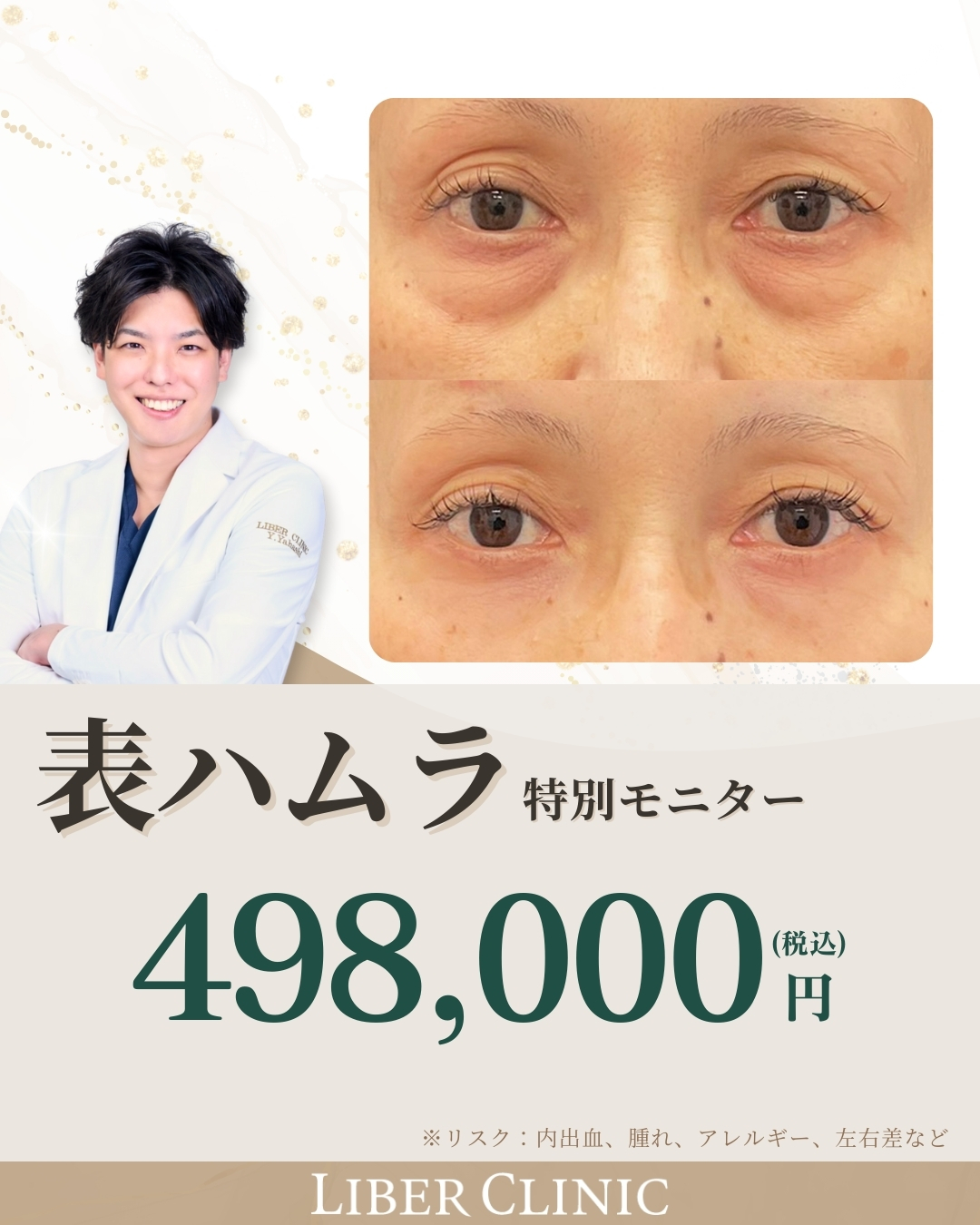 表ハムラ｜特別モニター