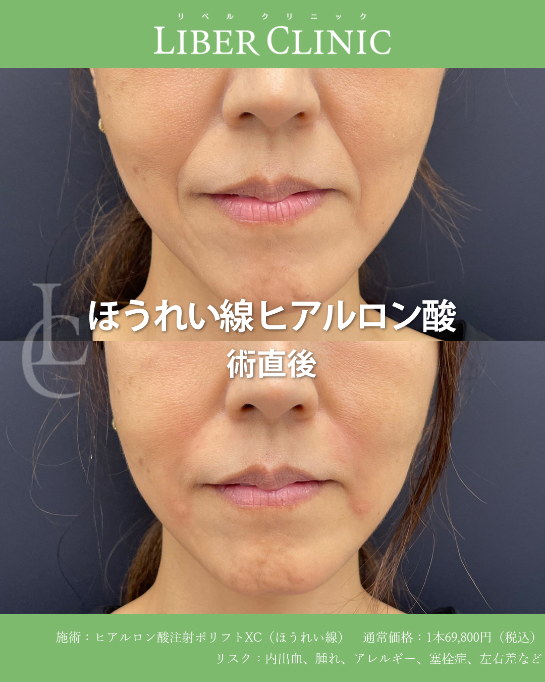 その悩み、注射で消せます