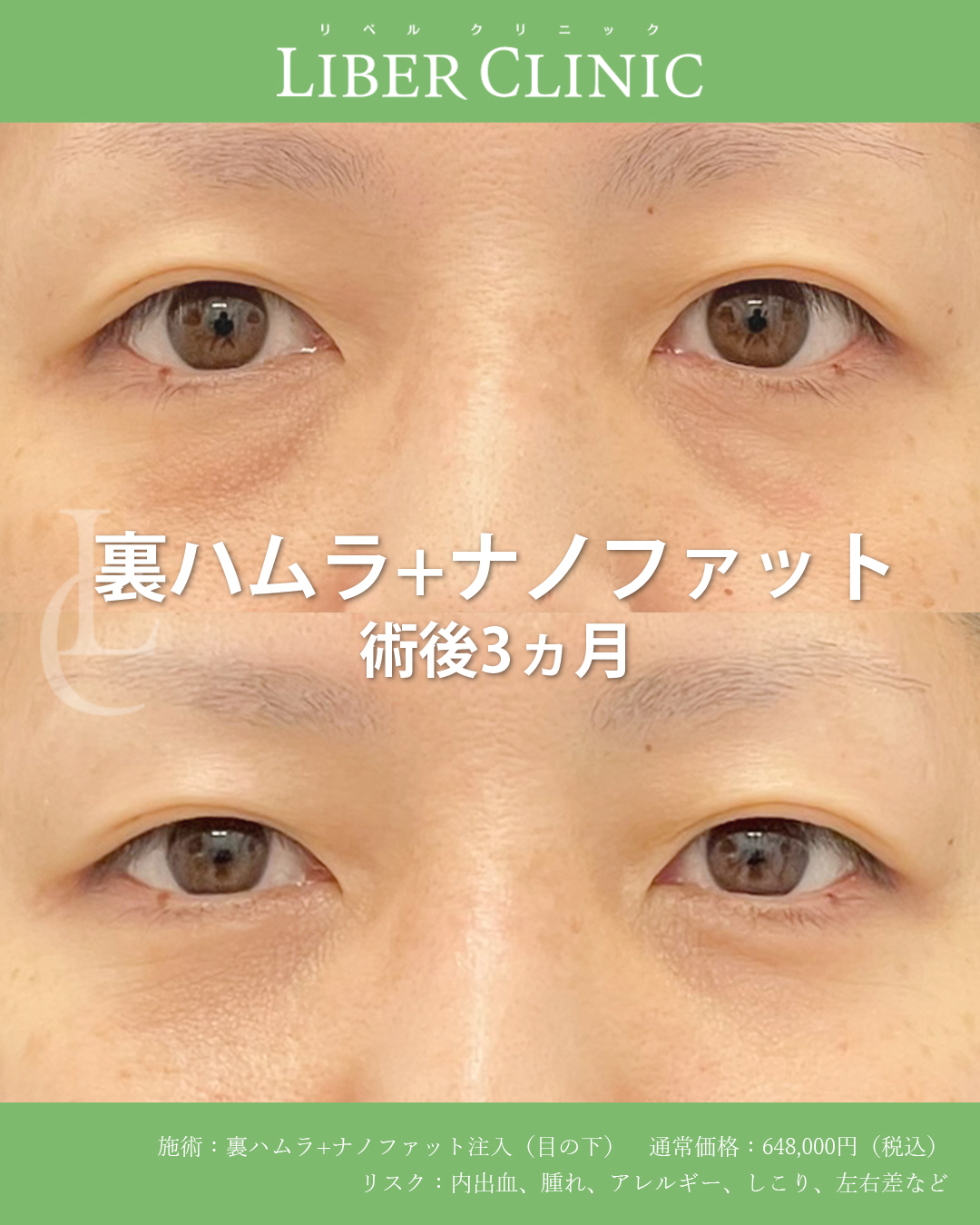 適切な診断と治療でクマの原因をすべて解消