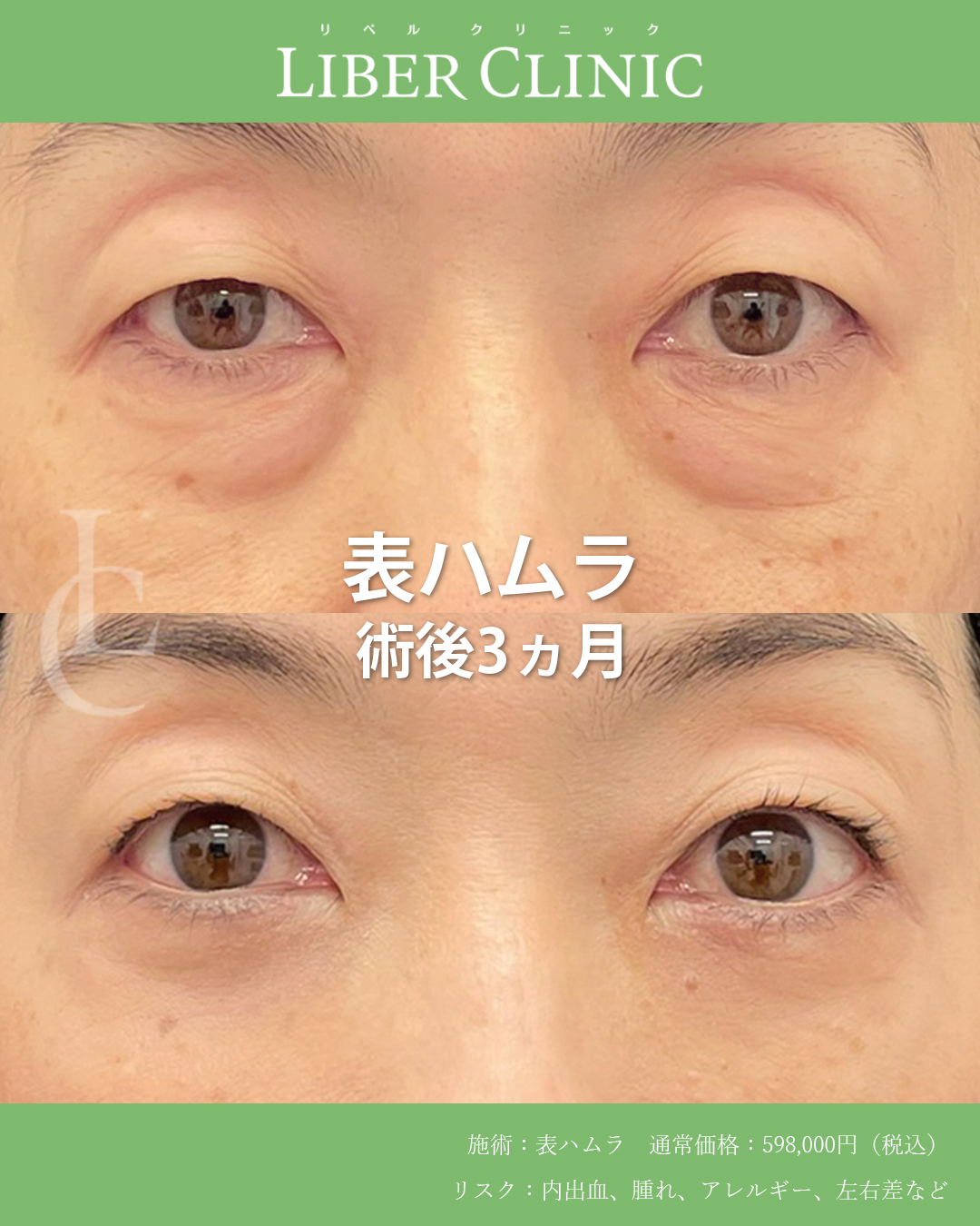 クマ治療は「診断」で決まる