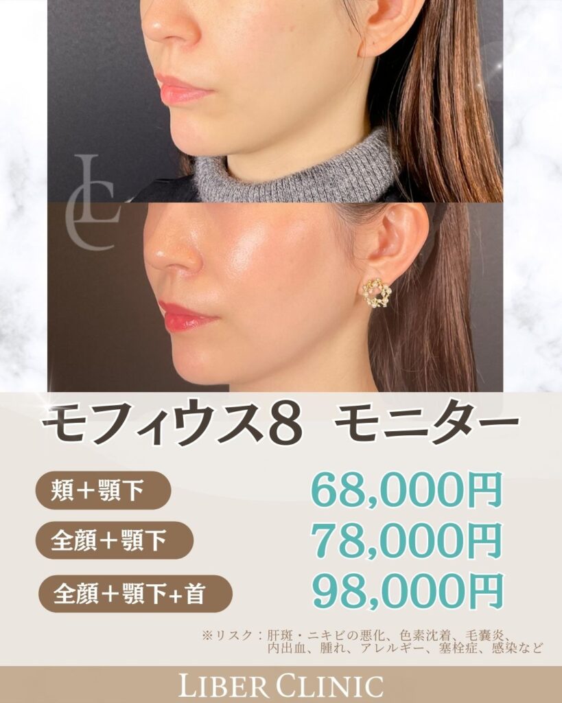 モフィウス８｜モニター